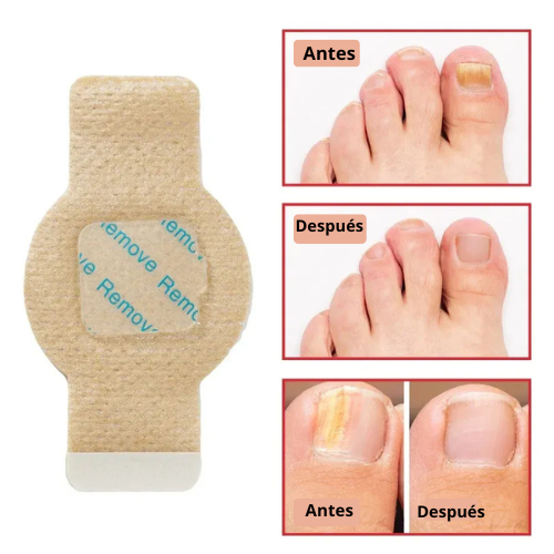 Bruma-Parches para Uñas |Tratamiento y Cuidado Diario para Uñas Dañadas