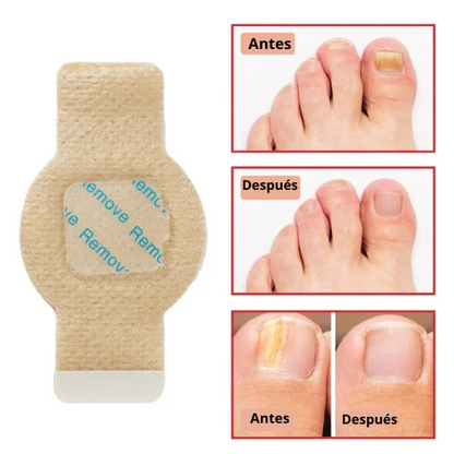 Bruma-Parches para Uñas |Tratamiento y Cuidado Diario para Uñas Dañadas